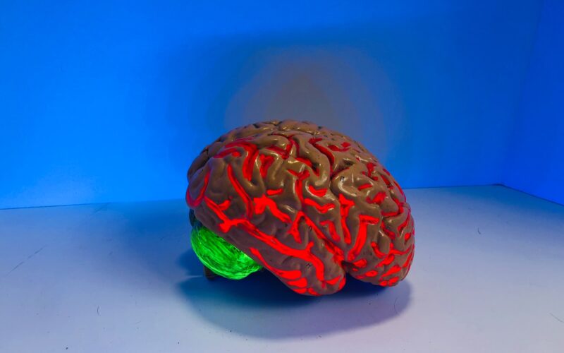 Ictus cerebrale: come fare prevenzione