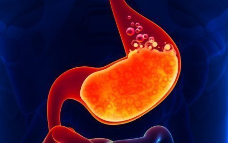 Sette cibi per combattere il reflusso gastroesofageo