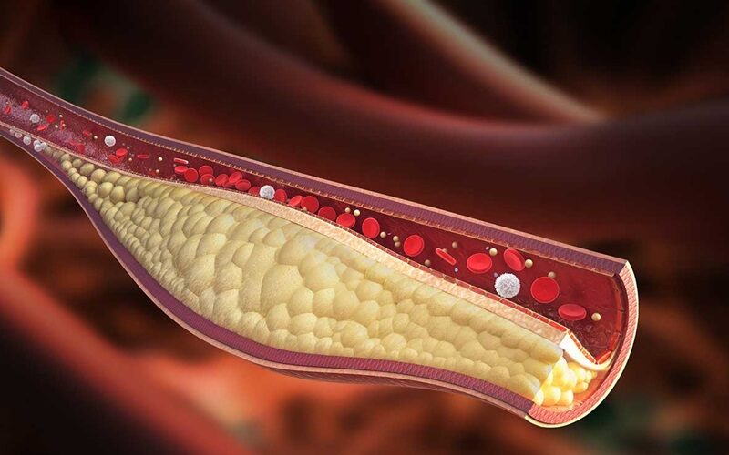 Colesterolo, quali sono i pregiudizi più diffusi?