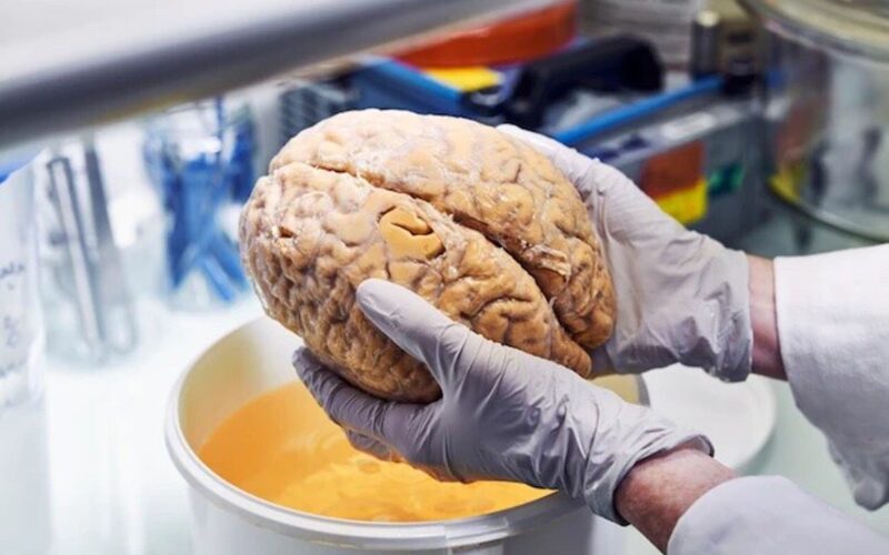 «Lo stress da pandemia ha fatto invecchiare il cervello dei giovani», lo studio scientifico su 163 ragazzi prima e dopo il Covid-19