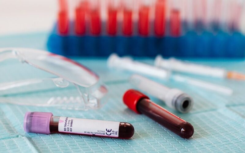 Perché sottoporsi periodicamente alle analisi del sangue è importante per la nostra salute