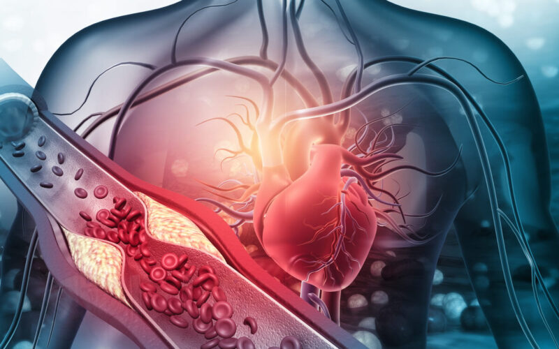 Gestione del Colesterolo Alto: Strategie per la Salute Cardiovascolare